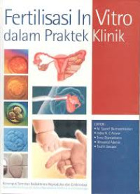 Image of Fertilisasi in vitro dalam praktek klinik